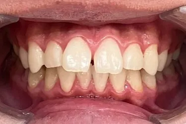 Before Image
