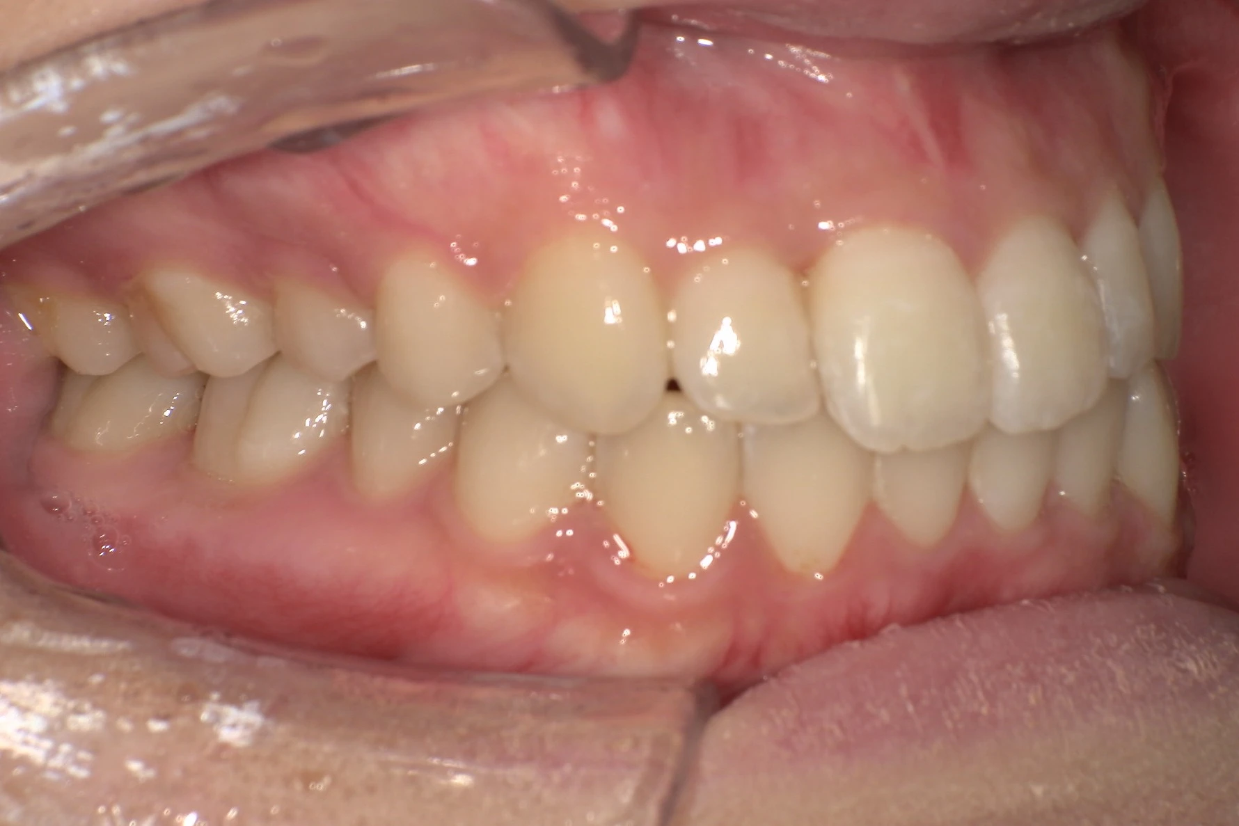 After Image