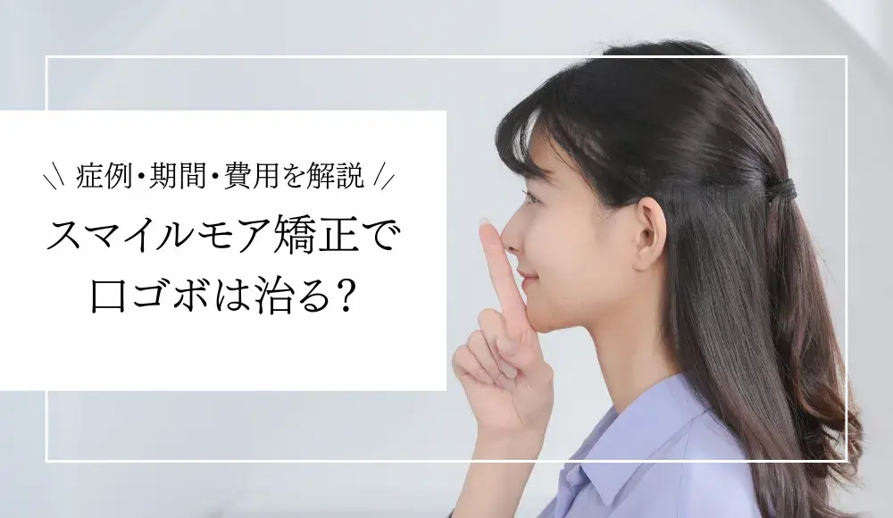 【スマイルモア矯正で口ゴボは治る？】効果や費用、治療期間について歯科医師が解説