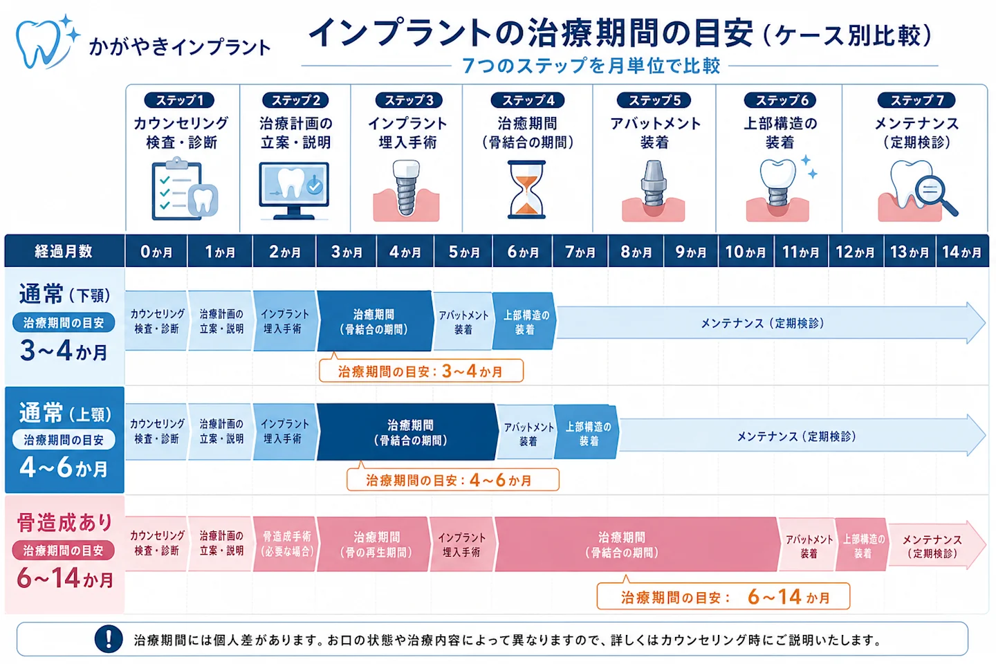 インプラントのケース別治療期間タイムライン:通常ケース・骨造成ありケース・抜歯即時埋入を月単位で比較した図