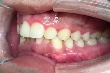 Before Image