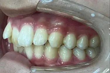 Before Image