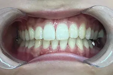 After Image