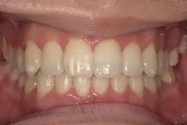 After Image