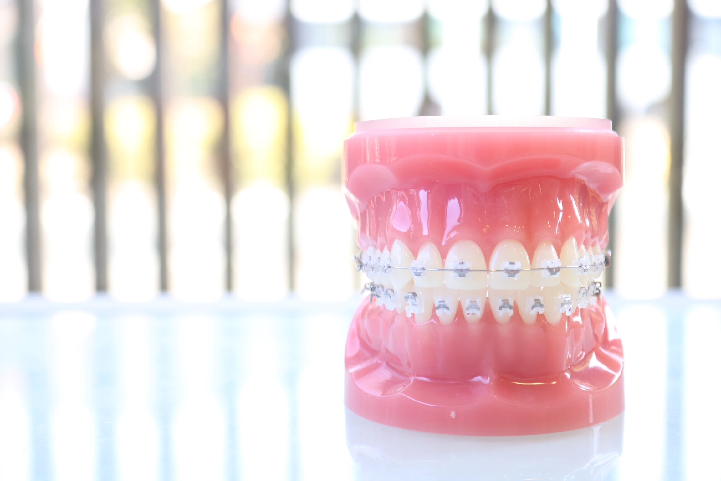 ガチャ歯の治療方法と費用