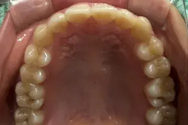 After Image