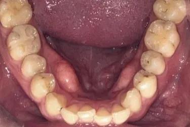Before Image