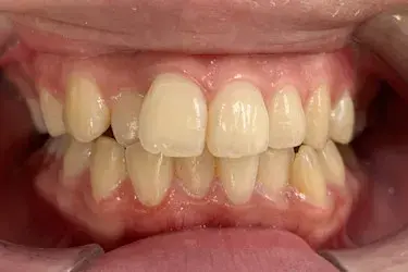Before Image