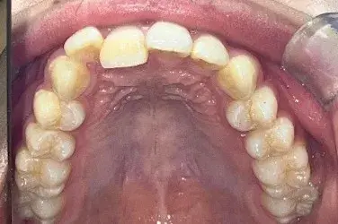 Before Image