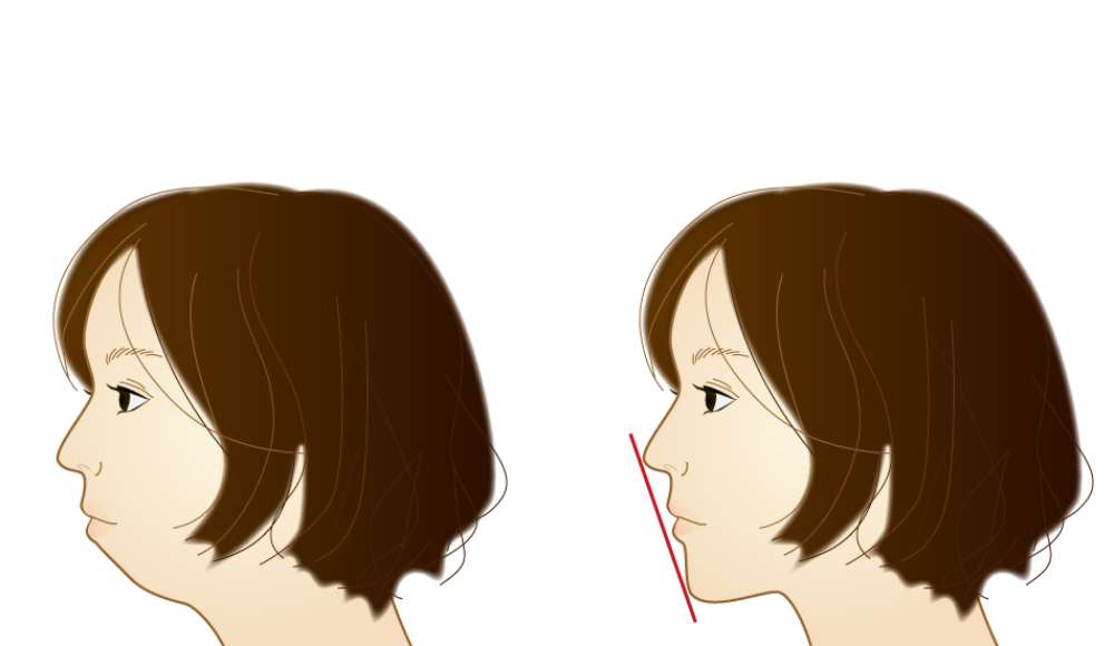 Eラインの説明画像