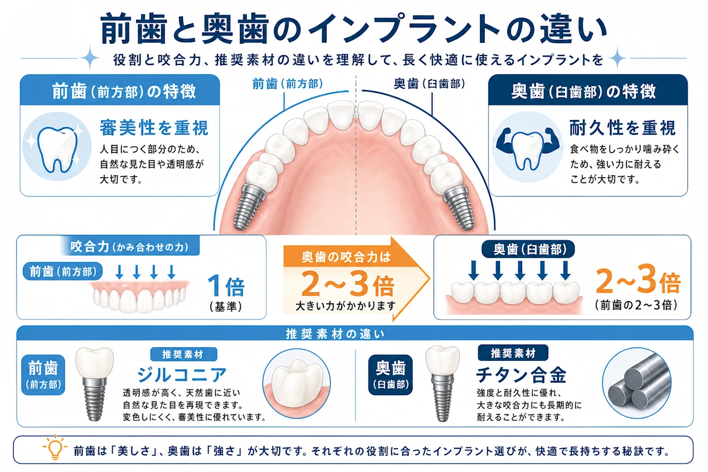 前歯と奥歯のインプラントの違いを示す図。奥歯は咬合力が大きく耐久性、前歯は審美性を重視する