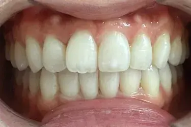 After Image