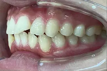 Before Image