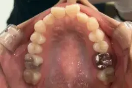 Before Image