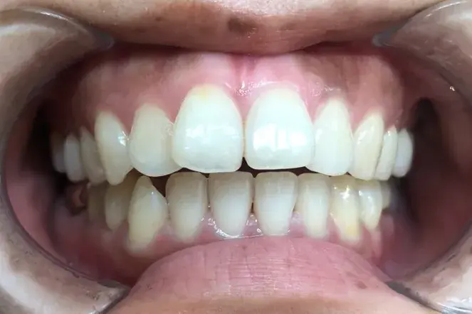 Before Image