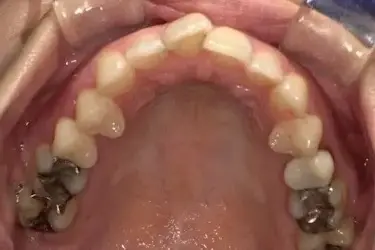 Before Image