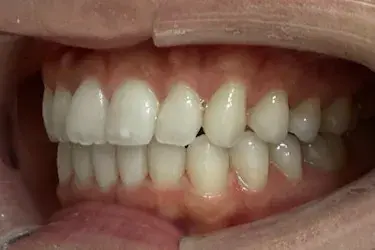 After Image