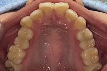 Before Image