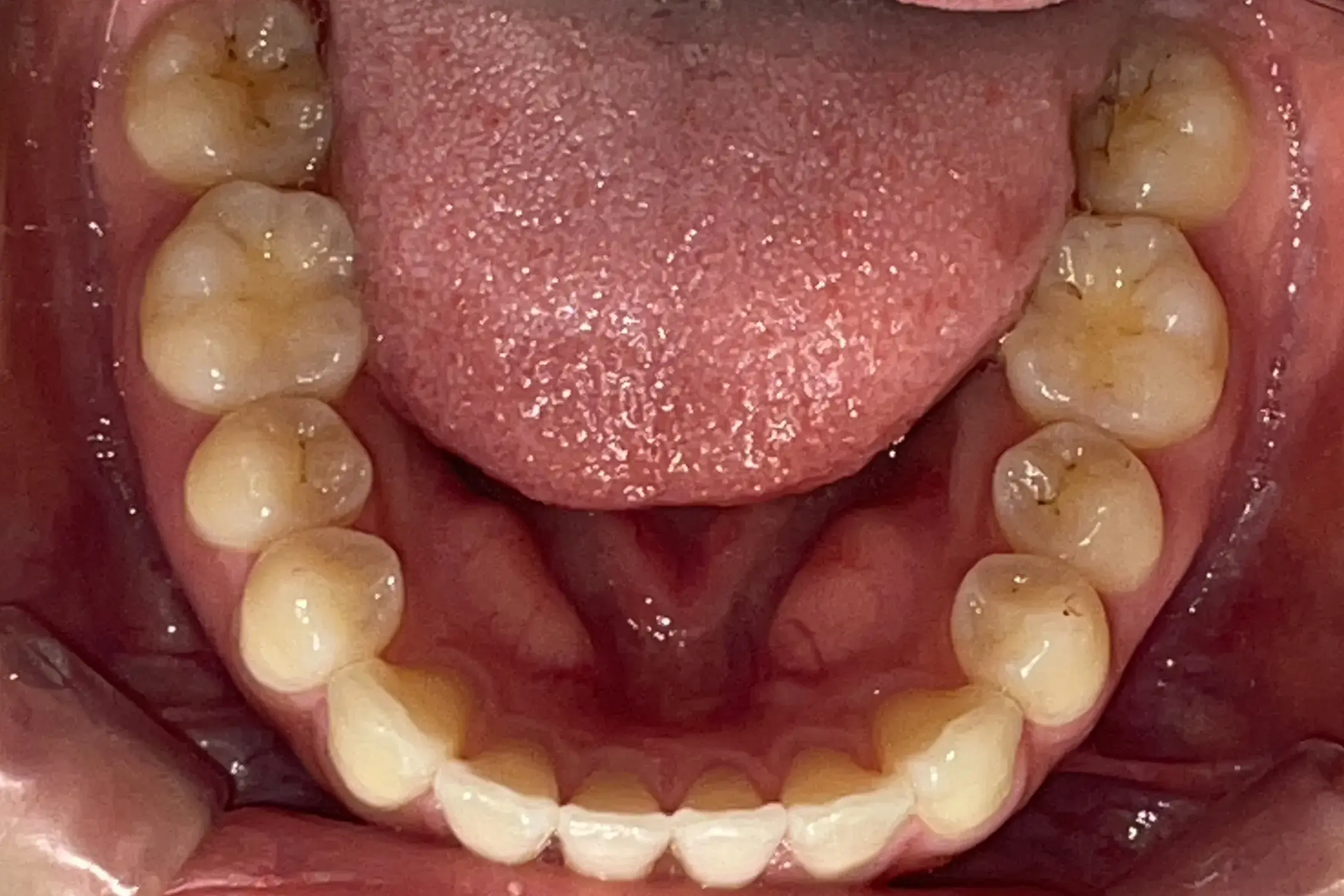 After Image