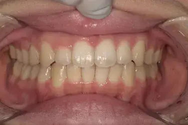 After Image