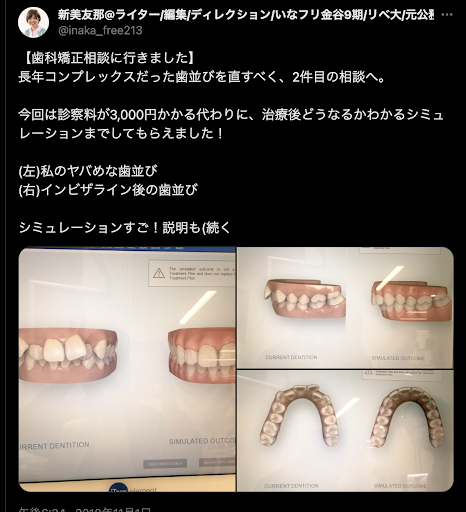 インビザライン治療計画の口コミ1