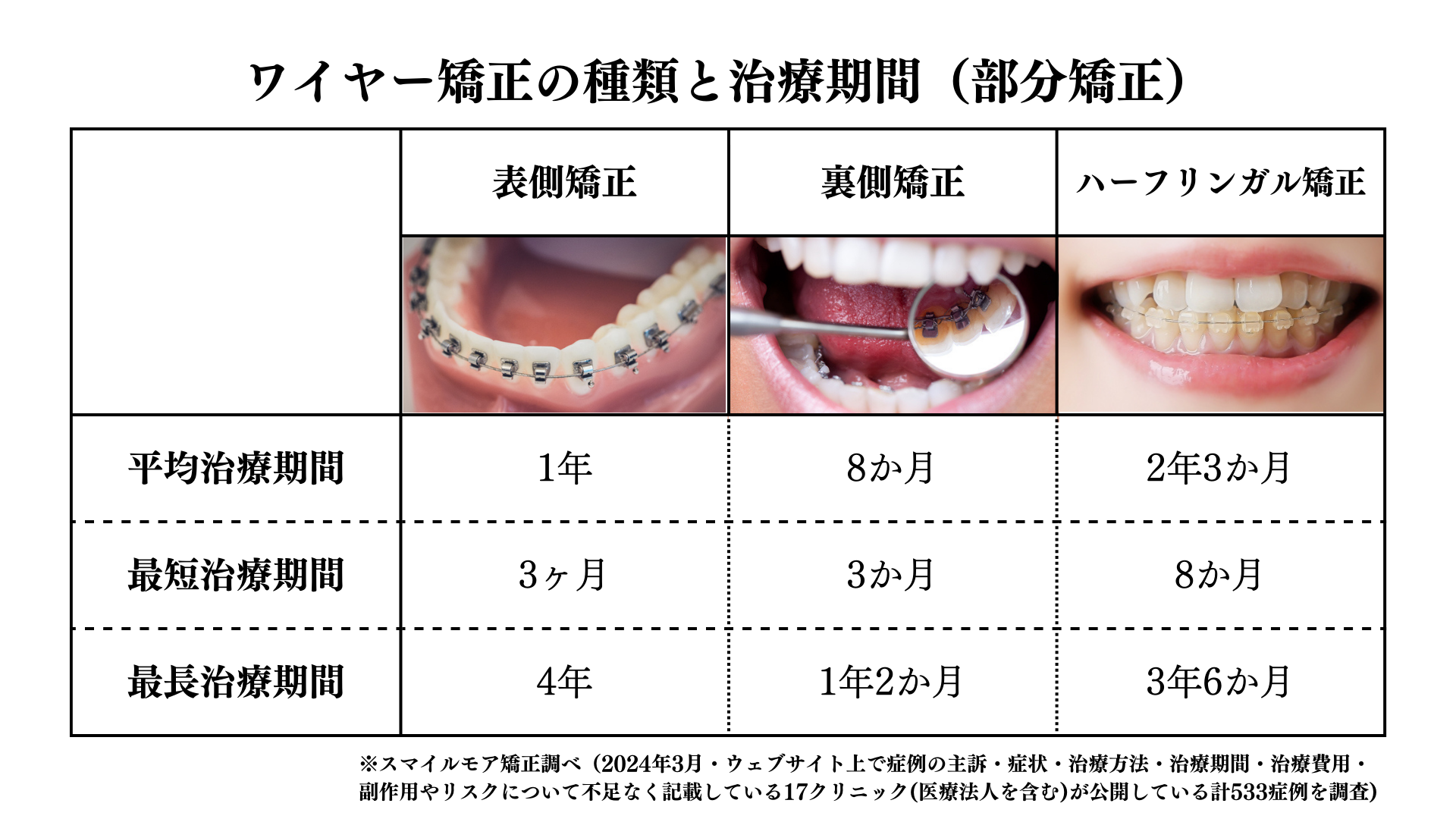 ワイヤー矯正の種類と治療期間（部分矯正）