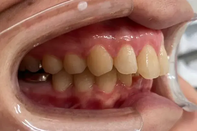 After Image