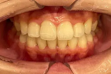 After Image