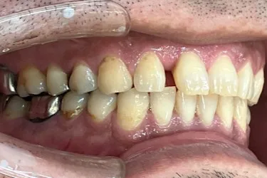 Before Image