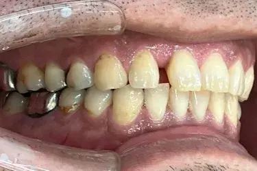 Before Image