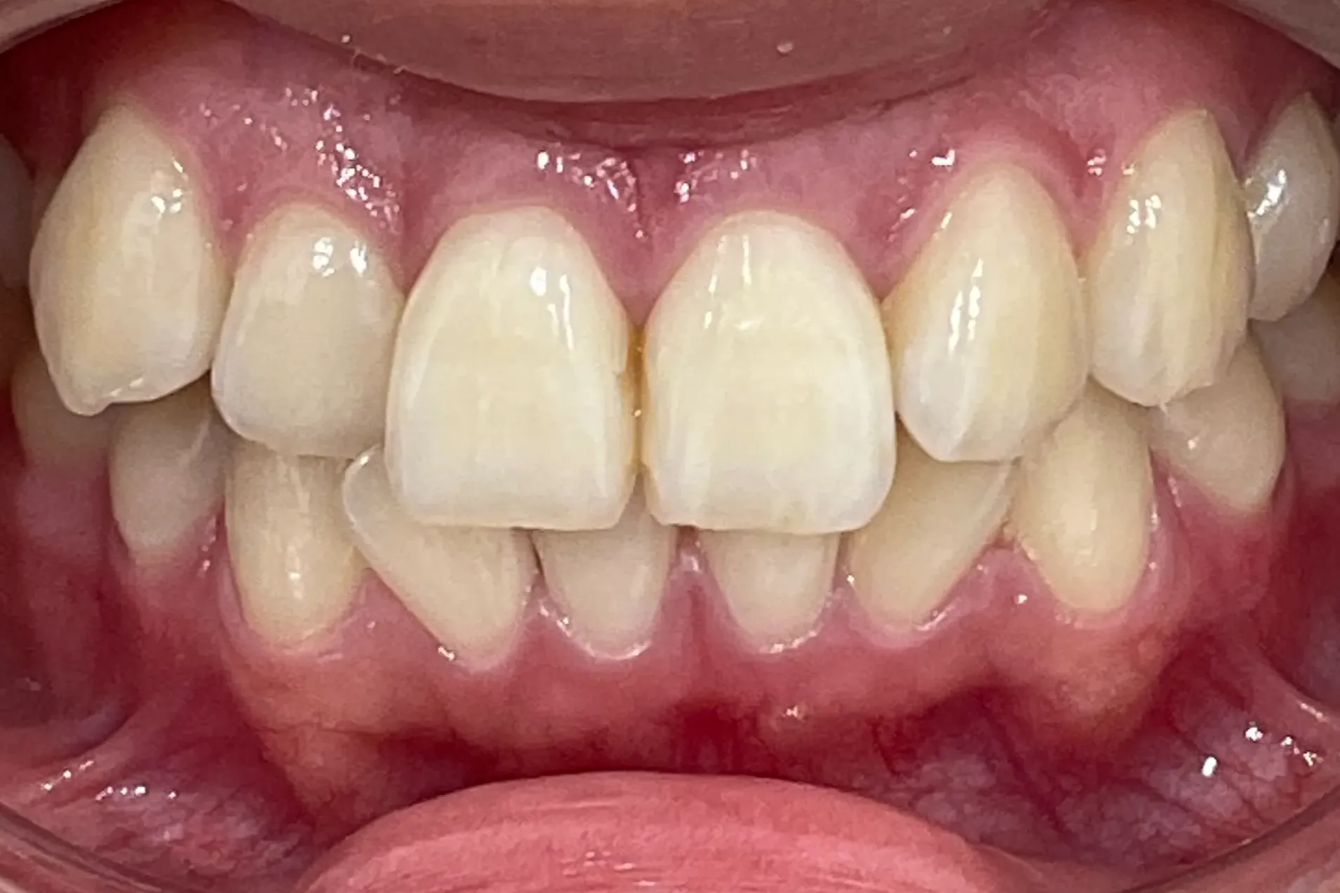 Before Image