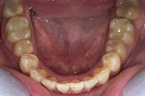 After Image