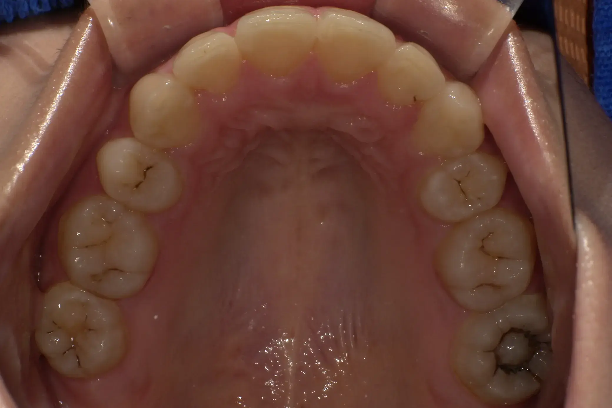 After Image