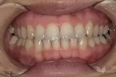 After Image