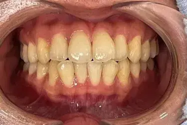 Before Image