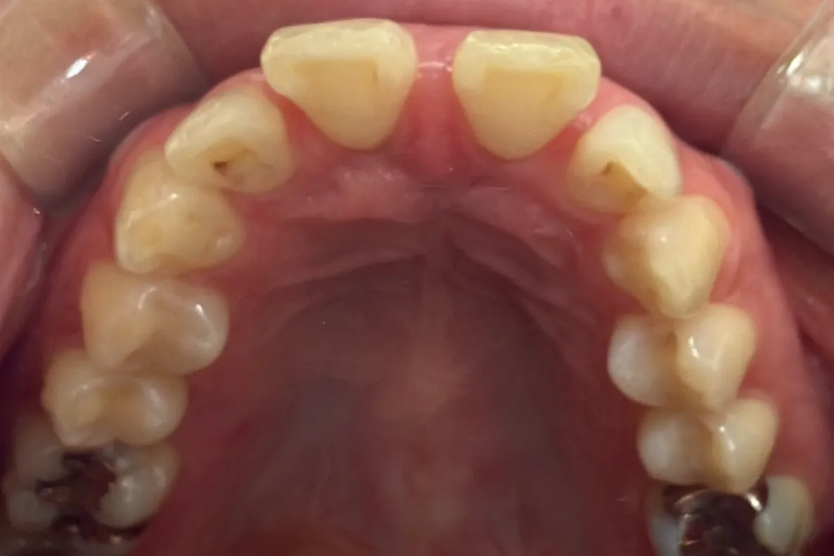 Before Image