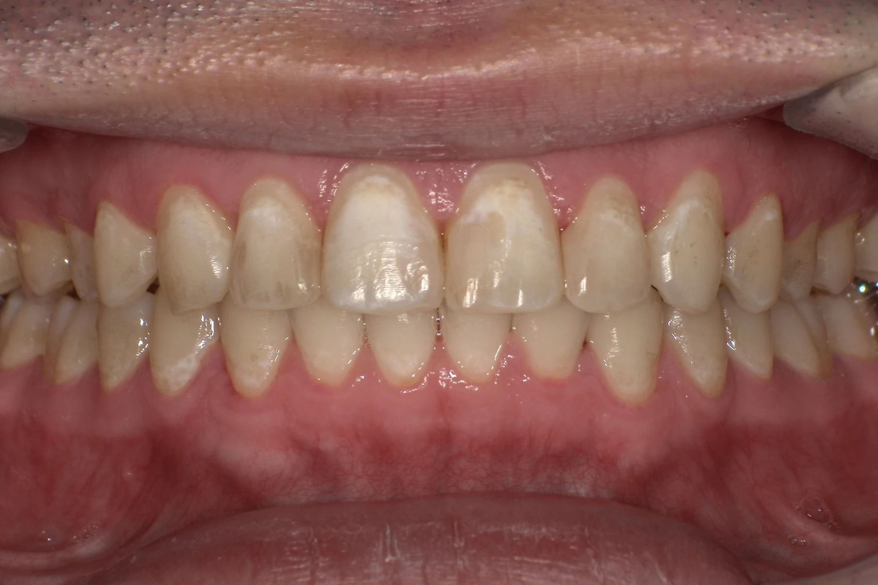 After Image