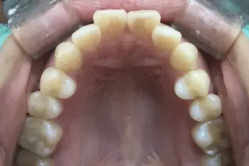 Before Image