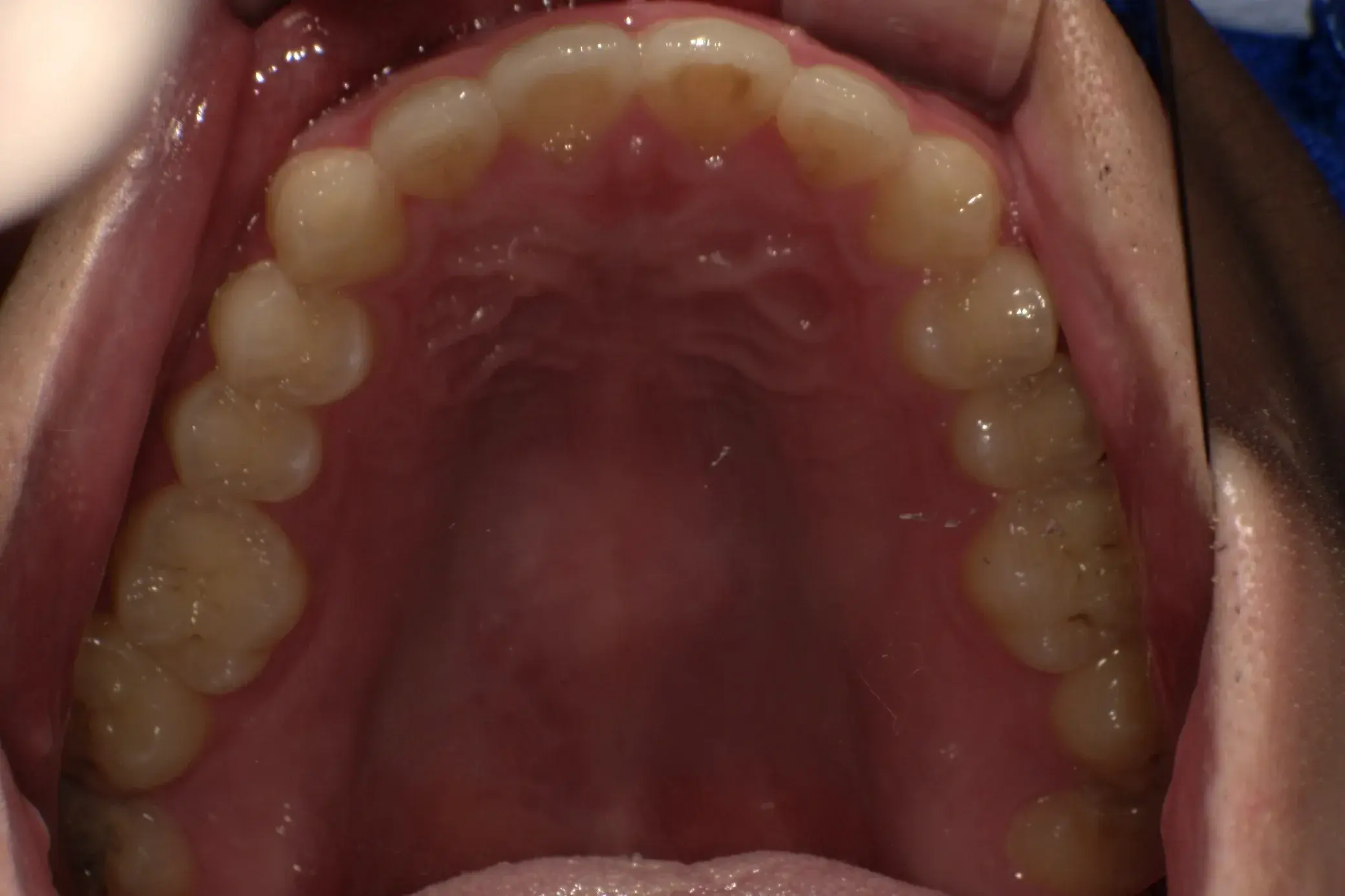 After Image