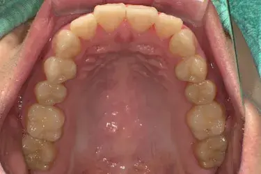 Before Image