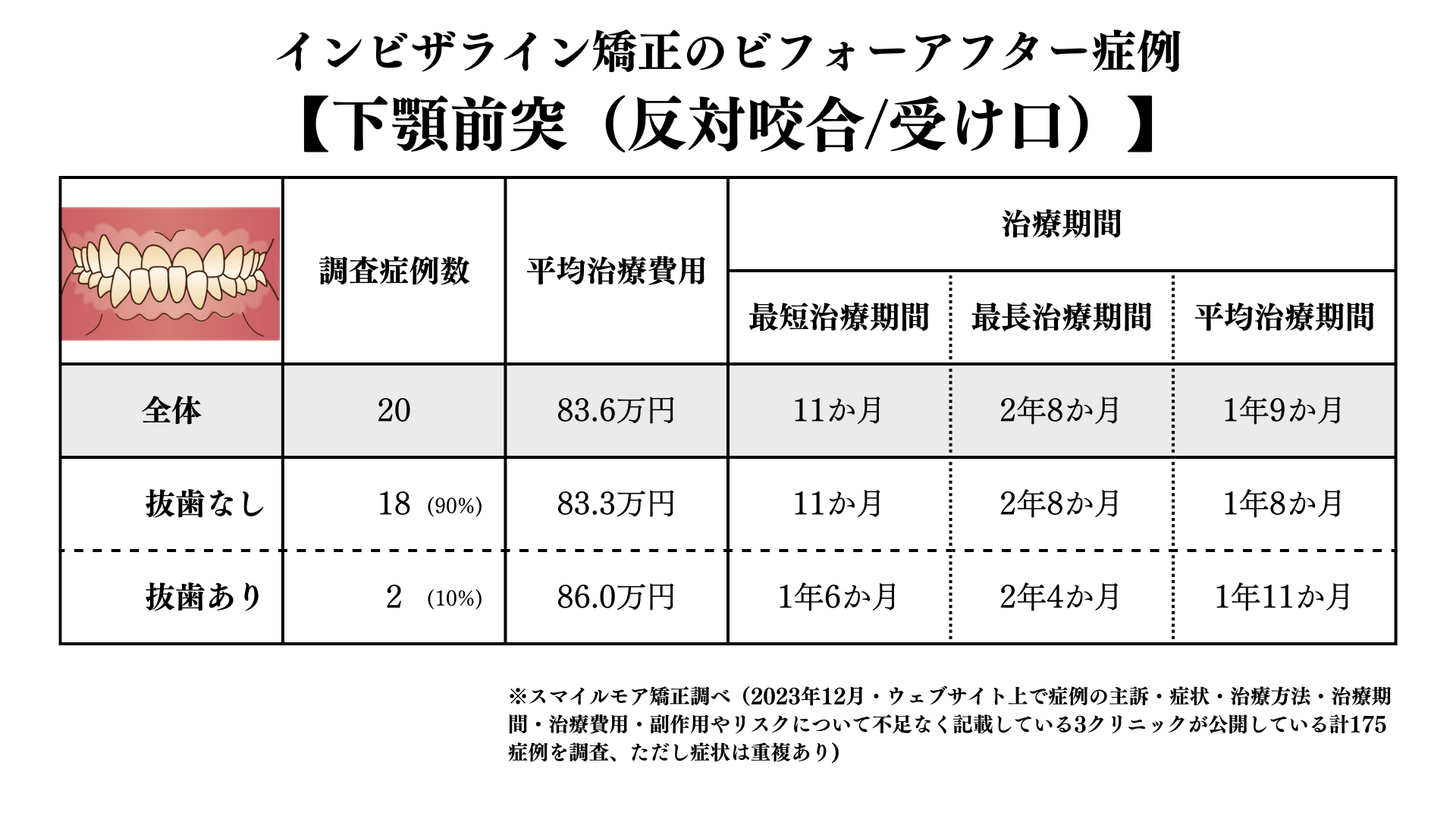 7インビザライン矯正の受け口のビフォアーアフター症例調査結果