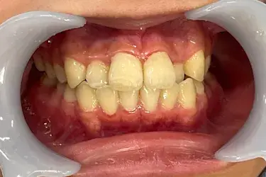 Before Image