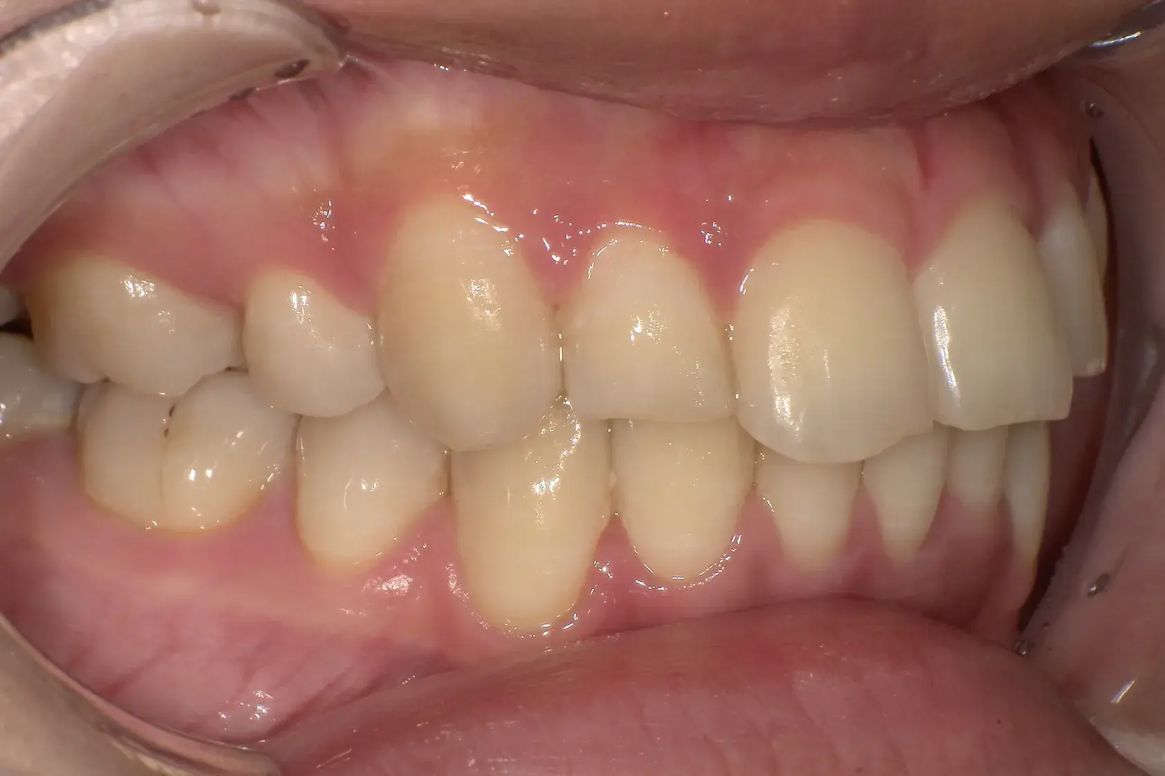 After Image