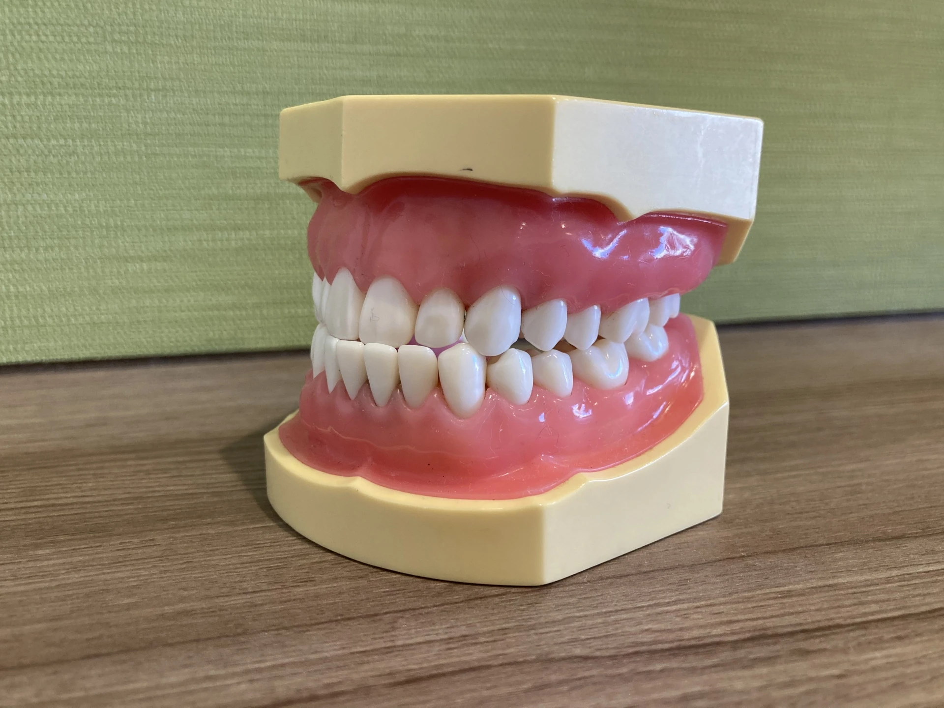 しゃくれとは