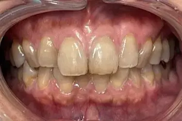 Before Image