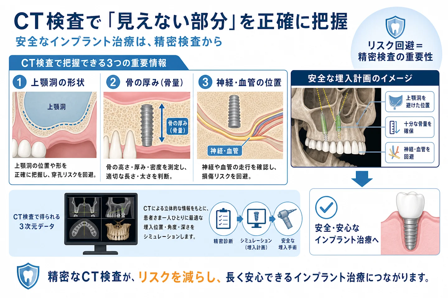 CT検査による上顎洞・骨量の3次元把握と安全な埋入計画を示す図