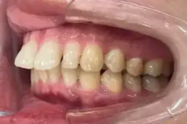 Before Image