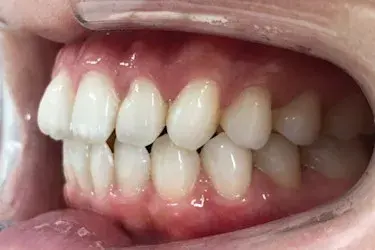 Before Image