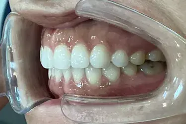 After Image