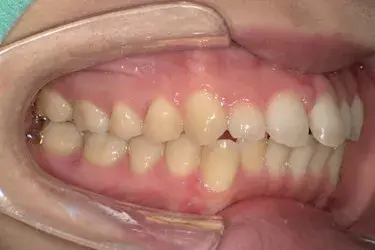 Before Image